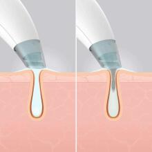 Homedics FAC-HY100 Refresh Hydra Facial