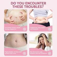 Yurhersu Pregnancy Cream Art.9799  Anti-stretch marks cream